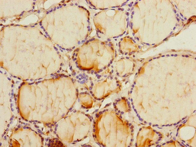 PMM2 Antibody in Immunohistochemistry (Paraffin) (IHC (P))