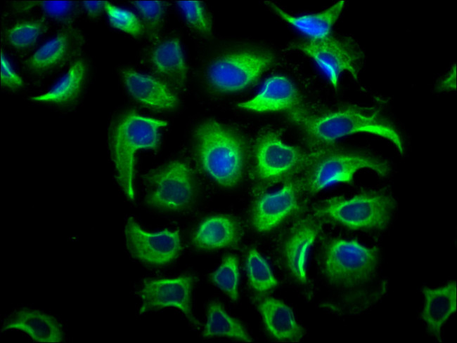 PP5 Antibody in Immunocytochemistry (ICC/IF)