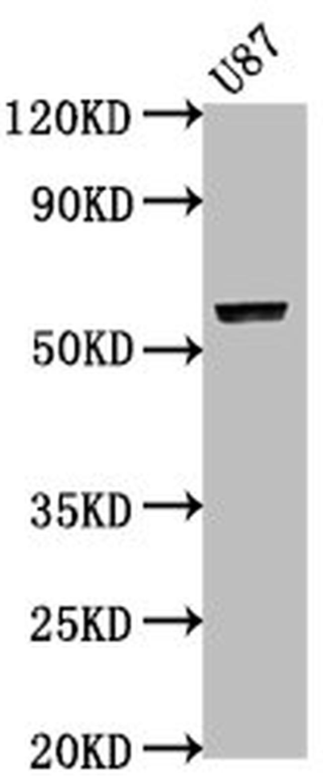PRAMEF17 Antibody in Western Blot (WB)