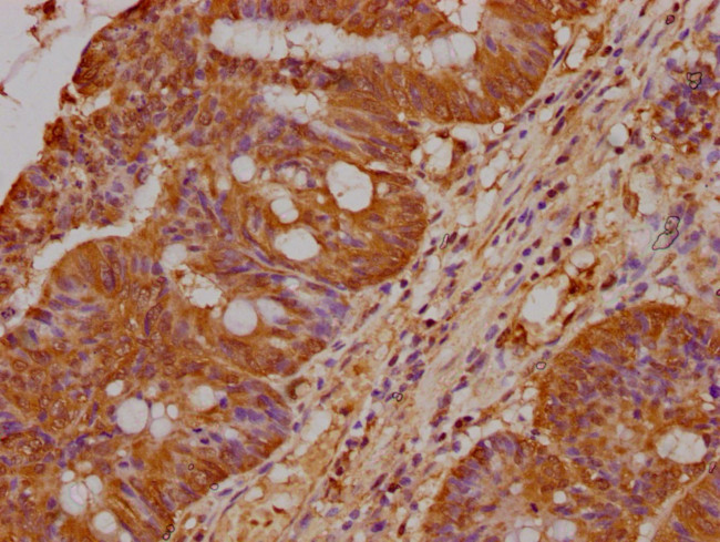 PRAMEF18 Antibody in Immunohistochemistry (Paraffin) (IHC (P))