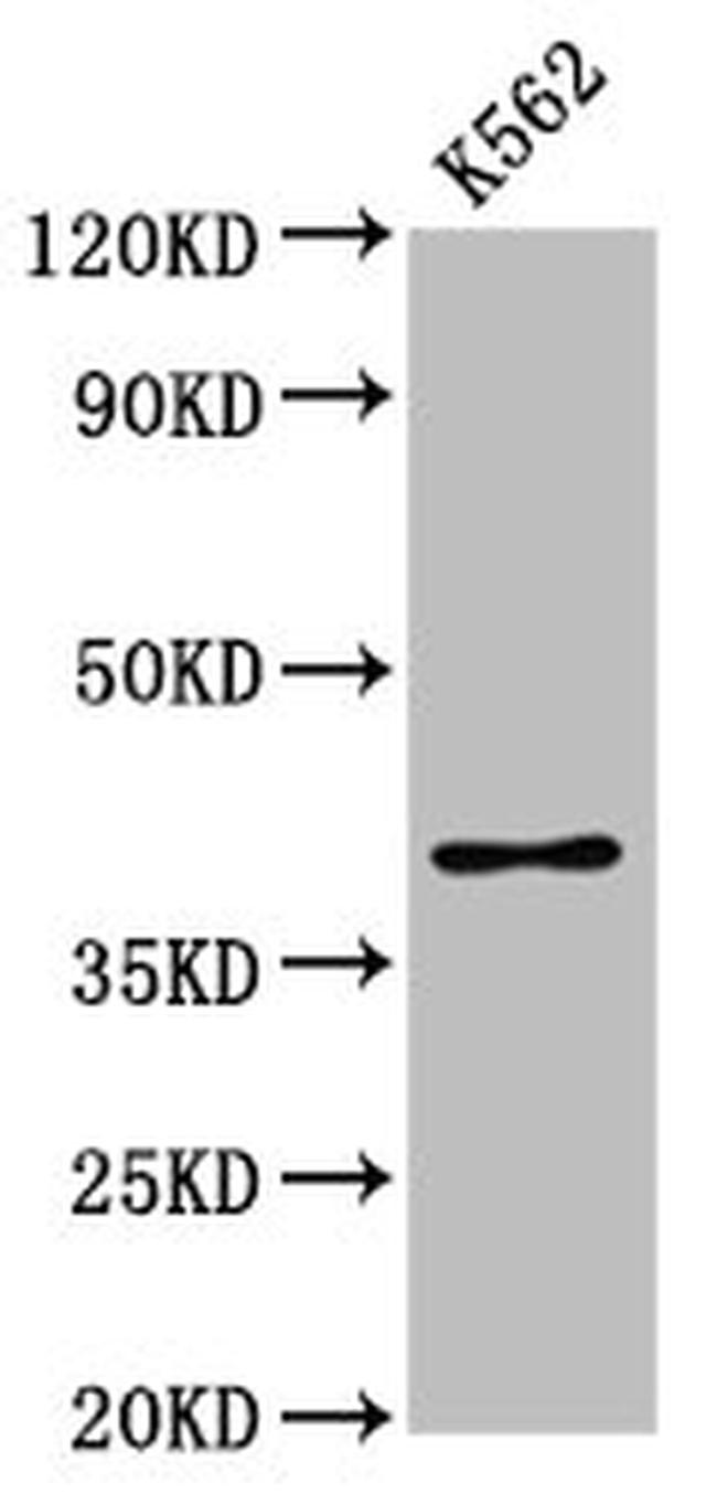 PRB1 Antibody in Western Blot (WB)