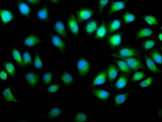 PREP Antibody in Immunocytochemistry (ICC/IF)