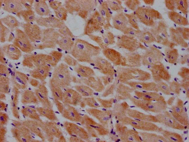 PRICKLE3 Antibody in Immunohistochemistry (Paraffin) (IHC (P))