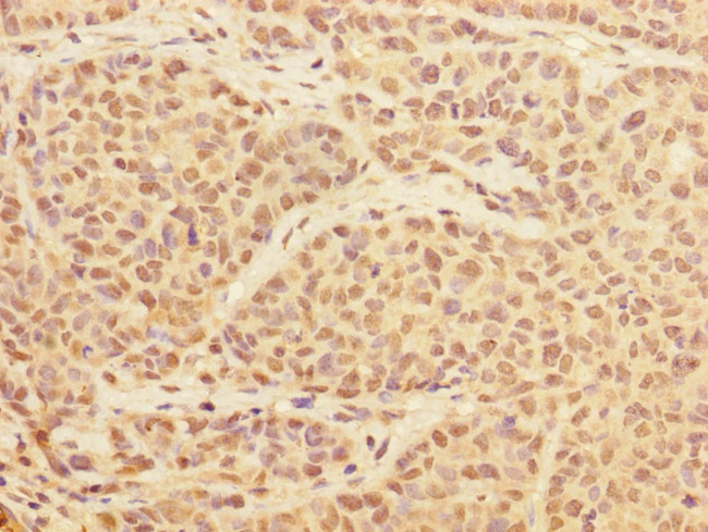 PRPF4 Antibody in Immunohistochemistry (Paraffin) (IHC (P))