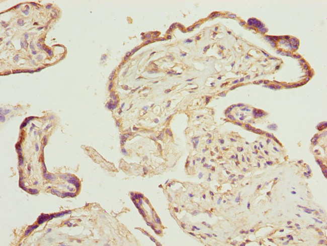 PTGES2 Antibody in Immunohistochemistry (Paraffin) (IHC (P))