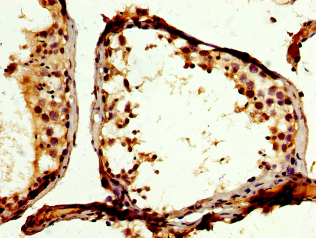 PTPN12 Antibody in Immunohistochemistry (Paraffin) (IHC (P))