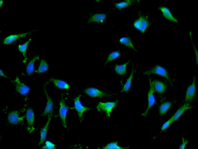 RAB25 Antibody in Immunocytochemistry (ICC/IF)