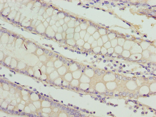 RAB3B Antibody in Immunohistochemistry (Paraffin) (IHC (P))