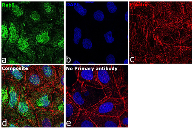 RAB9 Antibody in Immunocytochemistry (ICC/IF)