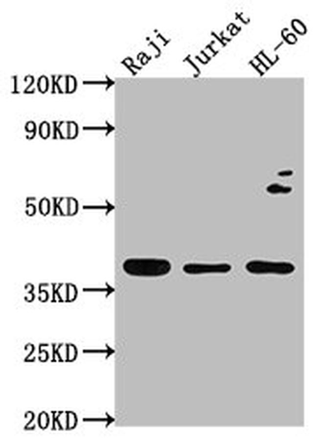RASSF2 Antibody in Western Blot (WB)
