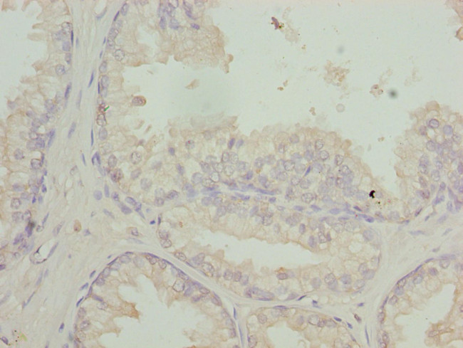 RFPL2 Antibody in Immunohistochemistry (Paraffin) (IHC (P))