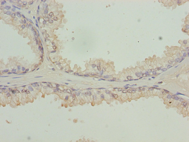 RFPL2 Antibody in Immunohistochemistry (Paraffin) (IHC (P))