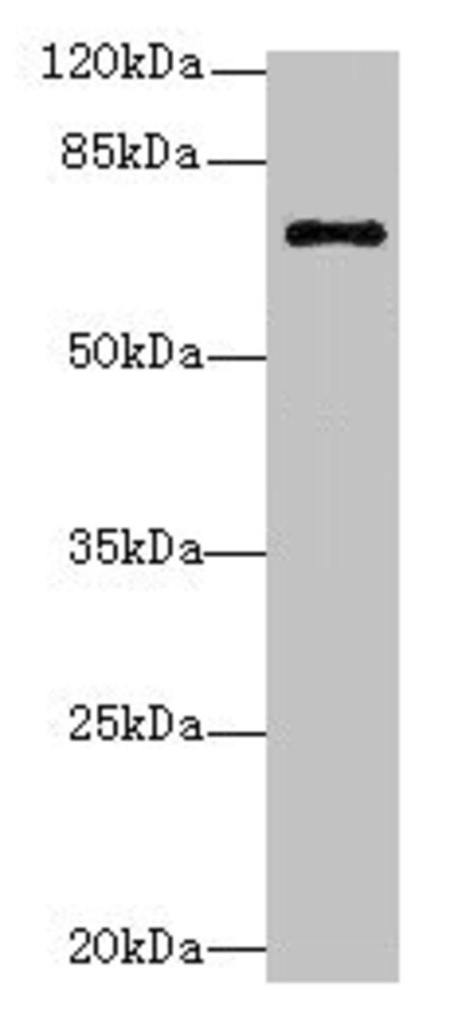 RhoBTB3 Antibody in Western Blot (WB)