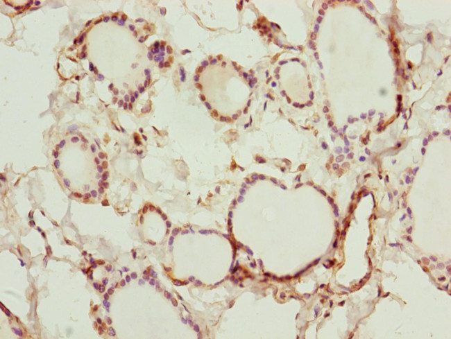 ZNF313 Antibody in Immunohistochemistry (Paraffin) (IHC (P))