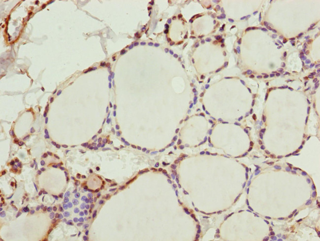 ZNF313 Antibody in Immunohistochemistry (Paraffin) (IHC (P))