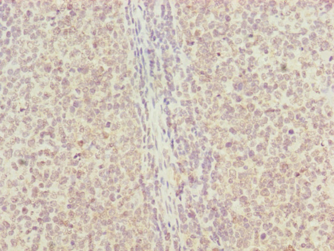 RNF13 Antibody in Immunohistochemistry (Paraffin) (IHC (P))
