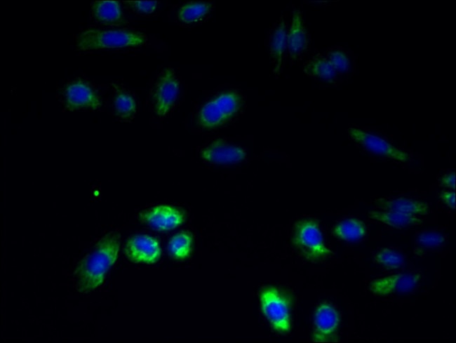 RNF26 Antibody in Immunocytochemistry (ICC/IF)