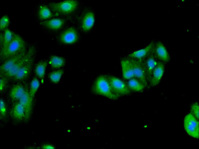 RPL4 Antibody in Immunocytochemistry (ICC/IF)