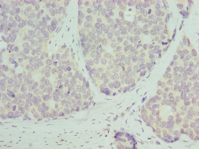 RPL9 Antibody in Immunohistochemistry (Paraffin) (IHC (P))