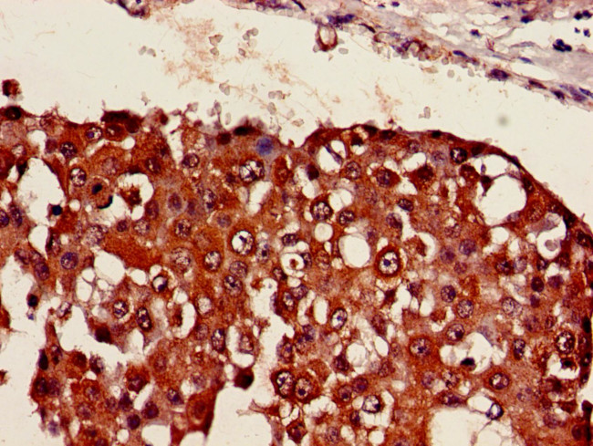 SESN1 Antibody in Immunohistochemistry (Paraffin) (IHC (P))