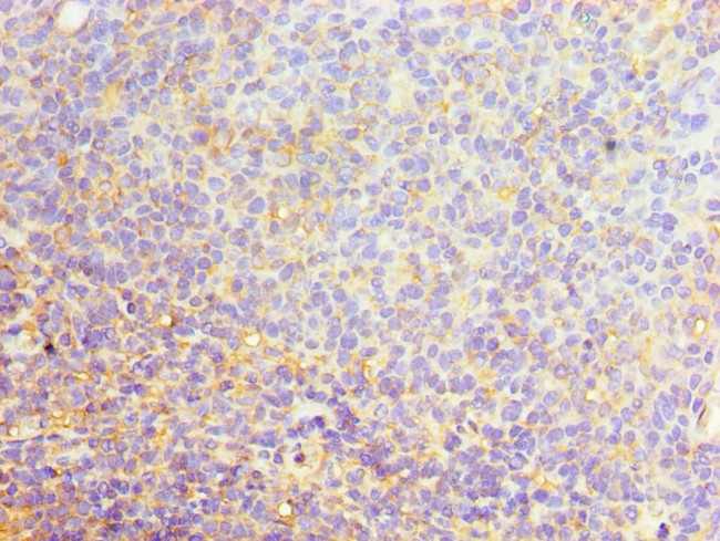 SRSF4 Antibody in Immunohistochemistry (Paraffin) (IHC (P))