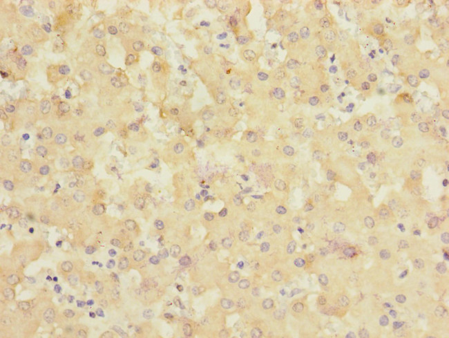 SLC6A12 Antibody in Immunohistochemistry (Paraffin) (IHC (P))