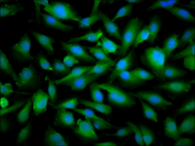 SNRPE Antibody in Immunocytochemistry (ICC/IF)