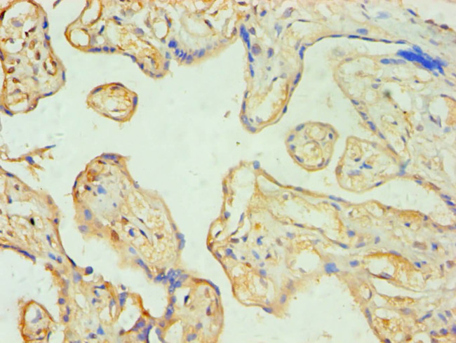 SOAT1 Antibody in Immunohistochemistry (Paraffin) (IHC (P))
