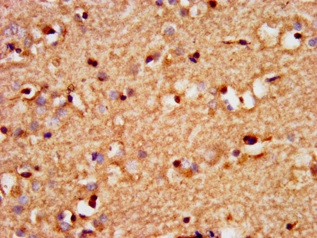 SOX3 Antibody in Immunohistochemistry (Paraffin) (IHC (P))