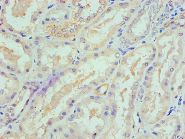 SPTLC1 Antibody in Immunohistochemistry (Paraffin) (IHC (P))