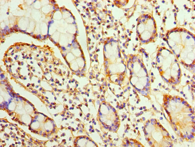 Sorcin Antibody in Immunohistochemistry (Paraffin) (IHC (P))