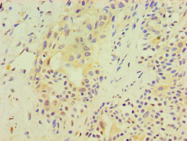 SRM Antibody in Immunohistochemistry (Paraffin) (IHC (P))