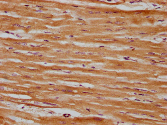 SRPX Antibody in Immunohistochemistry (Paraffin) (IHC (P))