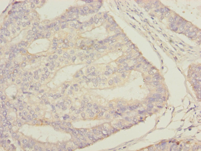 STAM2 Antibody in Immunohistochemistry (Paraffin) (IHC (P))