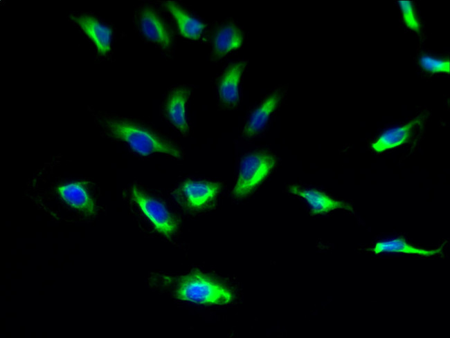 GPR91 Antibody in Immunocytochemistry (ICC/IF)