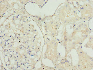 TAGLN2 Antibody in Immunohistochemistry (Paraffin) (IHC (P))