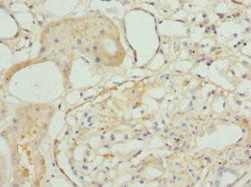 TAGLN2 Antibody in Immunohistochemistry (Paraffin) (IHC (P))