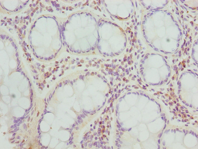 TARS Antibody in Immunohistochemistry (Paraffin) (IHC (P))