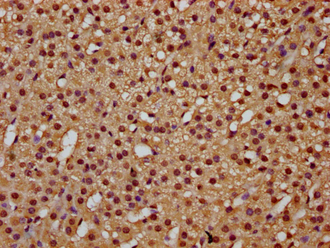 CA150 Antibody in Immunohistochemistry (Paraffin) (IHC (P))