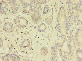 TK1 Antibody in Immunohistochemistry (Paraffin) (IHC (P))