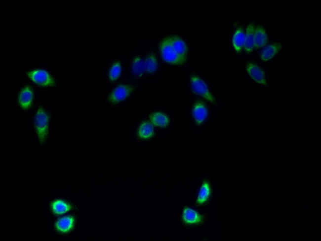 TMEM161A Antibody in Immunocytochemistry (ICC/IF)