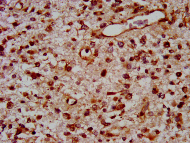 TOX Antibody in Immunohistochemistry (Paraffin) (IHC (P))