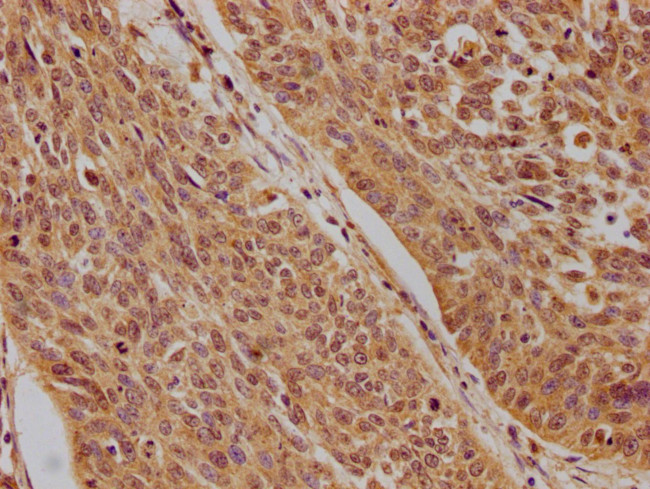 p73 Antibody in Immunohistochemistry (Paraffin) (IHC (P))