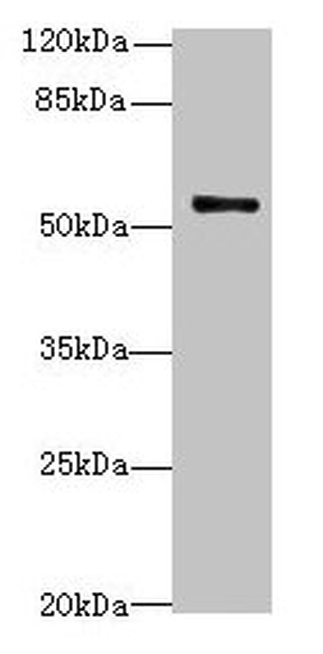 TRIM38 Antibody in Western Blot (WB)