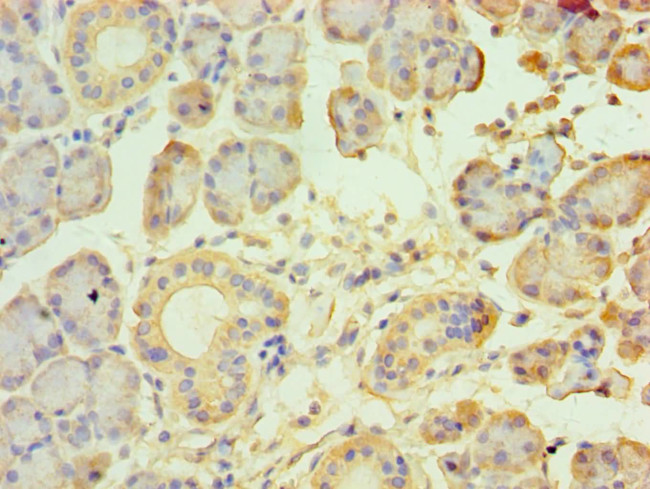 TRPM2 Antibody in Immunohistochemistry (Paraffin) (IHC (P))