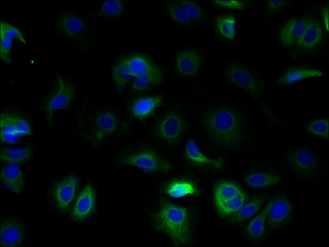 TSPAN5 Antibody in Immunocytochemistry (ICC/IF)