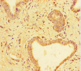 TUBA1C Antibody in Immunohistochemistry (Paraffin) (IHC (P))