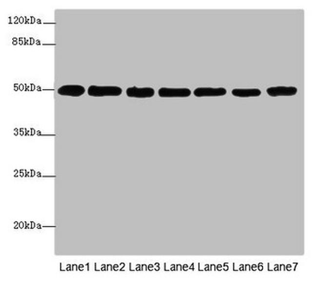beta Tubulin Antibody in Western Blot (WB)