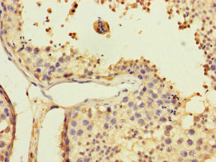USP5 Antibody in Immunohistochemistry (Paraffin) (IHC (P))