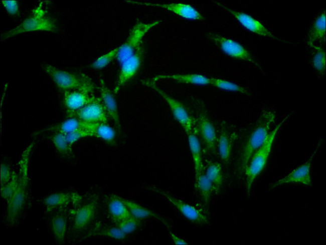 WASP Antibody in Immunocytochemistry (ICC/IF)